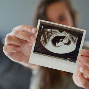 Shot of a woman holding a sonogram of her unborn baby